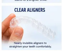 Clear Aligners