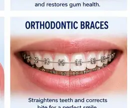 Orthodontic Braces